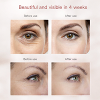 Kenaria LumiMask™️ Pro ⭐️